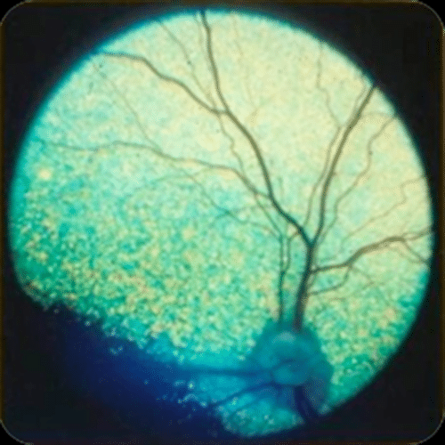 fundus, normal retina, dog, indirect ophthalmoscopy