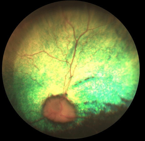 Atrophie rétine, Hyperréflectivité, chien, fond d'oeil, pupille dilatée, vision, nuit, aveugle, cécité