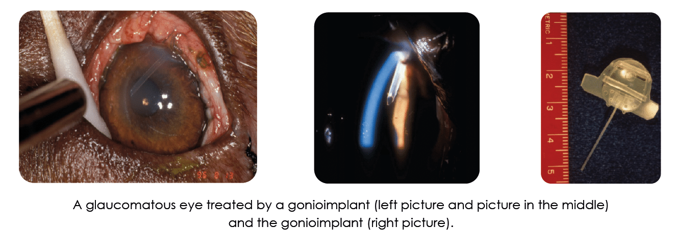 gonioimplant, glaucoma,Surgical options, glaucoma, eye, pressure, dog, cat