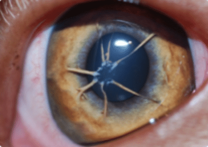 Persistent pupillary membranes, iris, birth, dog, cat, strands