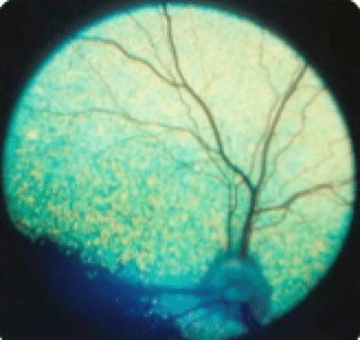 Sudden acquired retinal degeneration, SARD, blindness, lost of vision, dog, female, middle age