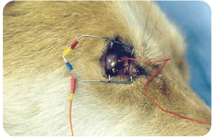 Tests, cataracts, surgery, ultrasound, eye, imaging, retina, detachment, ERG, examination