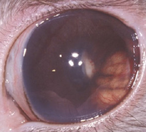 Encephalitozoon cuniculi, lapin, torticoli, cataracte, masse, oeil, parasite 